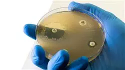 posgrado resistencia antimicrobianos salud animal farmacia