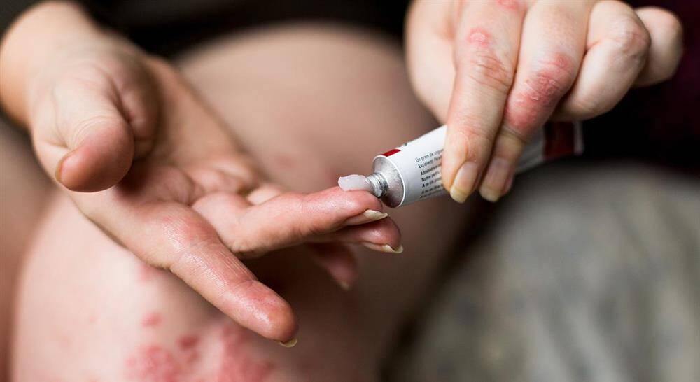 curso dermatología y nutracéuticos