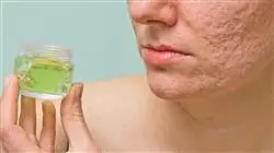 diplomado online dermatologia nutraceuticos