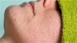 ##IMAGE##
