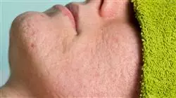 ##IMAGE##