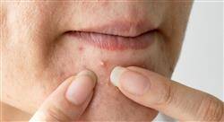 cursos microbiota de la piel para farmacia