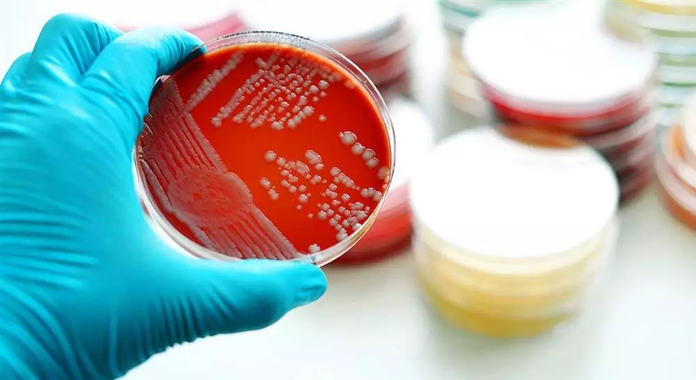 curso online probióticos prebióticos microbioma y salud para farmacia