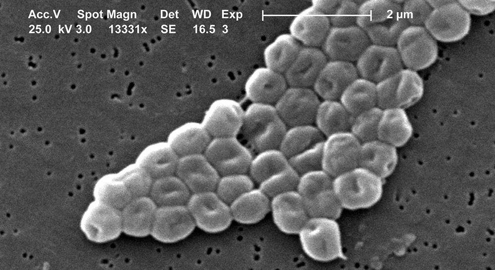 formacion microbiótica intolerancia y alergias para farmacia