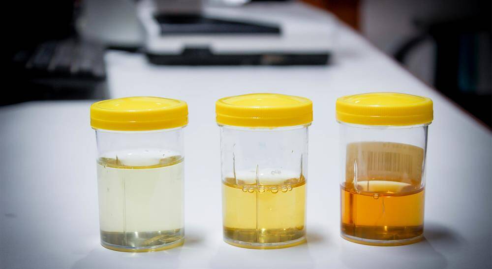 curso microbiótica genitourinaria para farmacia