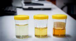 curso microbiótica genitourinaria para farmacia