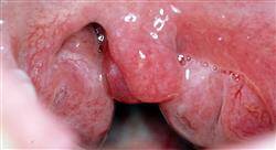 formacion microbiota oral y respiratoria para farmacia