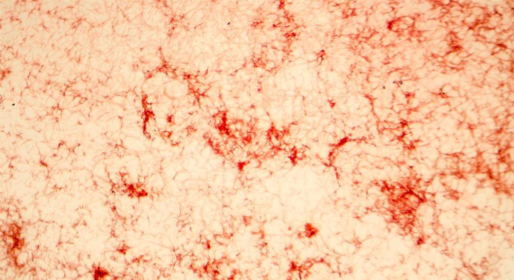 maestria enfermedades infecciosas Tech Universidad