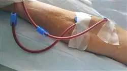 ##IMAGE##