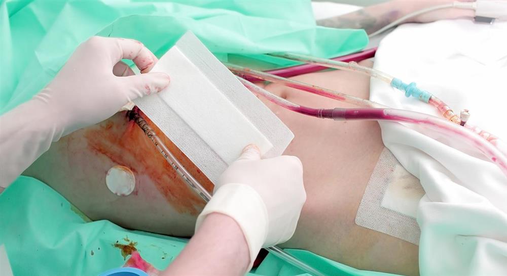 experto universitario trasplante renal para enfermería