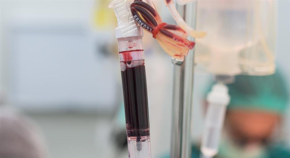 estudiar diálisis peritoneal para enfermería