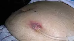 ##IMAGE##