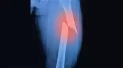 ##IMAGE##