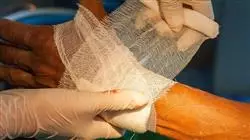 diplomado online enfermeria traumatologia ortopedia patologia miembro superior