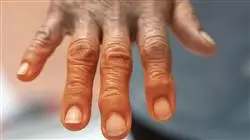 ##IMAGE##