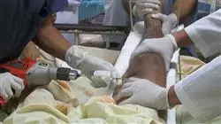diplomado online enfermeria traumatologia ortopedia patologia miembro inferior