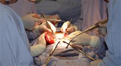 curso trasplante renal para enfermería