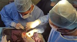 posgrado trasplante renal para enfermería