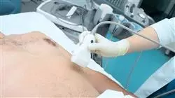 ##IMAGE##