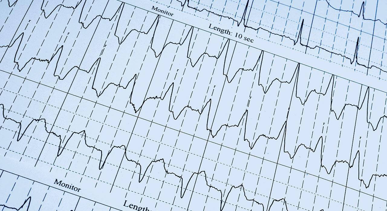 Especialización en Enfermería en Urgencias Vitales en Atención Primaria