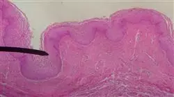 ##IMAGE##