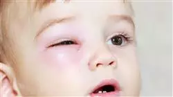 ##IMAGE##
