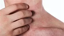 ##IMAGE##