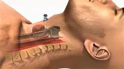 ##IMAGE##