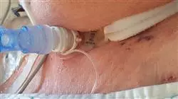 ##IMAGE##