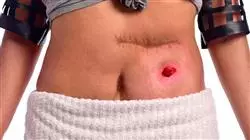 ##IMAGE##