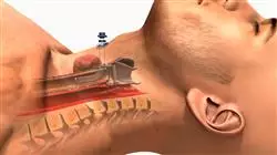 ##IMAGE##