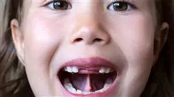 ##IMAGE##
