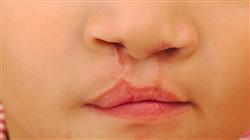 1 odontologia trastorno orofacial enfermeria portada