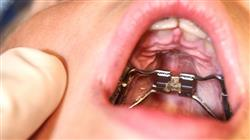 5 odontologia trastorno orofacial enfermeria portada