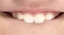 diplomado online odontologia trastorno orofacial enfermeria