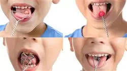 posgrado odontologia trastorno orofacial enfermeria