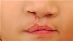 ##IMAGE##