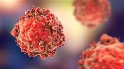 cursos enfermeria cuidados nino leucemia