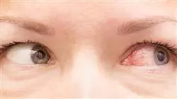 formacion urgencias enfermedades oculares enfermeria Tech Universidad