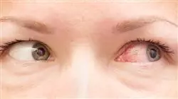 ##IMAGE##
