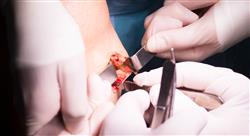 e abordaje avanzado urgencias traumatologicas Tech Universidad