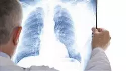 ##IMAGE##