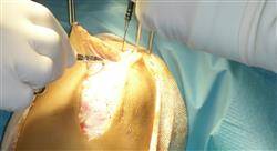 diplomado instrumentación y suturas quirúrgicas