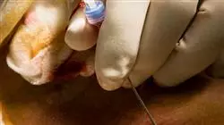 especializacion online emergencias medicas enfermeria