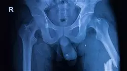 ##IMAGE##