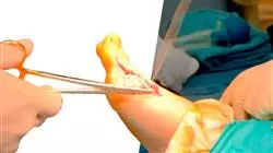 ##IMAGE##