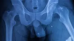 ##IMAGE##