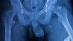 ##IMAGE##
