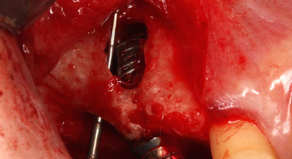 formacion cirugía maxilofacial para enfermería