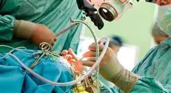curso online cirugía oftalmológica para enfermería